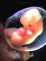 Не визуализируется эмбрион