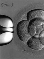 Перенос эмбрионов на 3 день