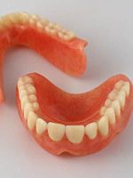 Съемные зубные протезы – какие лучше?