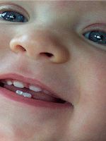 Сколько молочных зубов у детей?