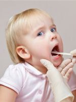 Трахеит у ребенка - лечение
