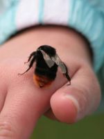 Укус пчелы – первая помощь