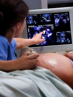 УЗИ в 33 недели беременности - нормы