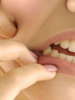 Воспаление надкостницы зуба