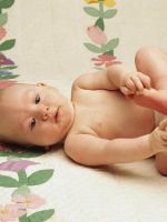 Вывих тазобедренного сустава у новорожденных