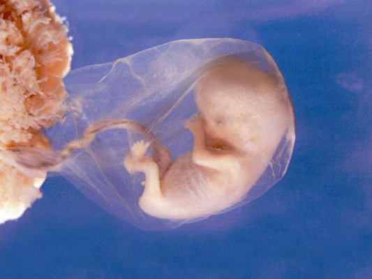 Как выглядит эмбрион 3 недели фото