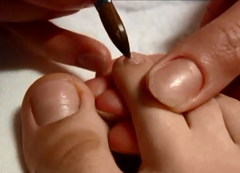 Toenail extension step by step 2