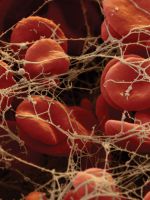 Низкие тромбоциты в крови – причина