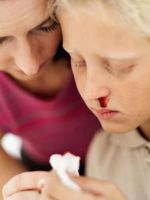 Почему у ребенка часто идет кровь из носа – причины 