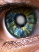 Симптомы катаракты на ранних стадиях 