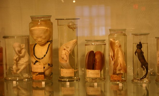 Забальзамированные тела эмбрионов человека и животных в музее Германа Бургаве